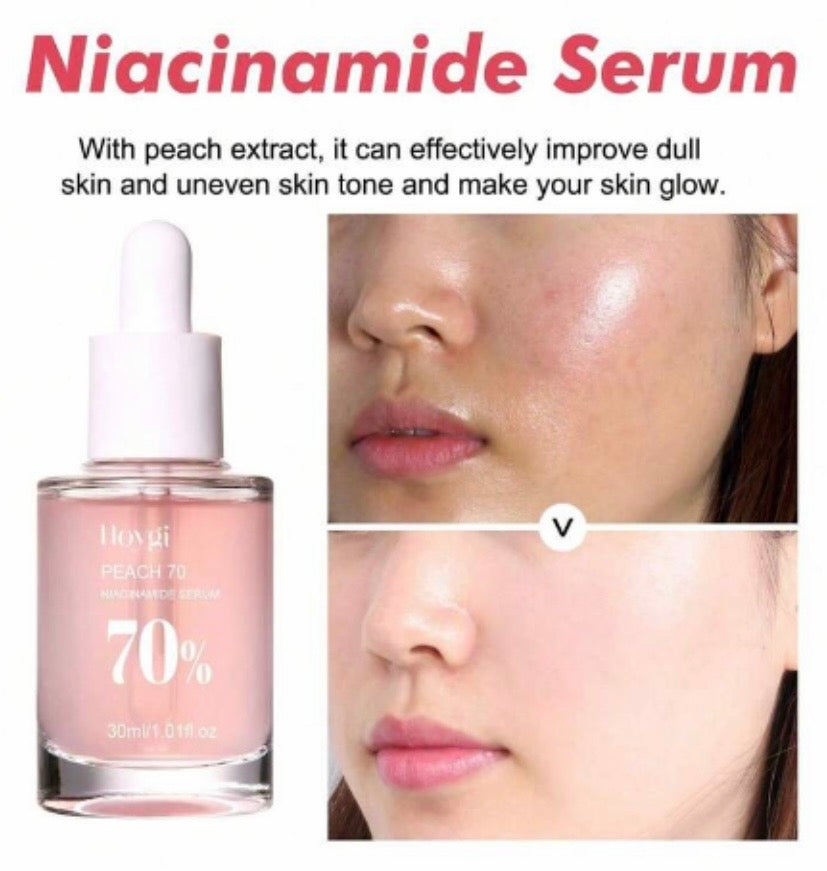 Sérum Niacinamide – Anti-Imperfections & Éclat Naturel